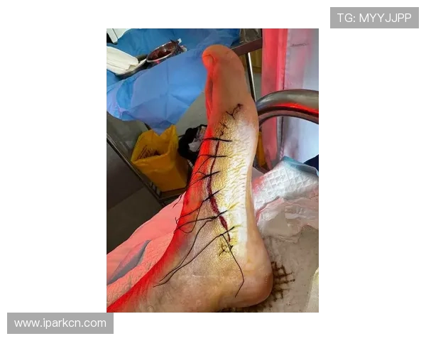 武磊膝微骨折手术内幕曝光真相 武磊膝微骨折手术内幕曝光真相